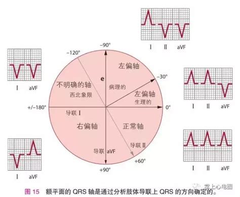 逆時針|心臟呈逆鐘向轉位，怎麼辦